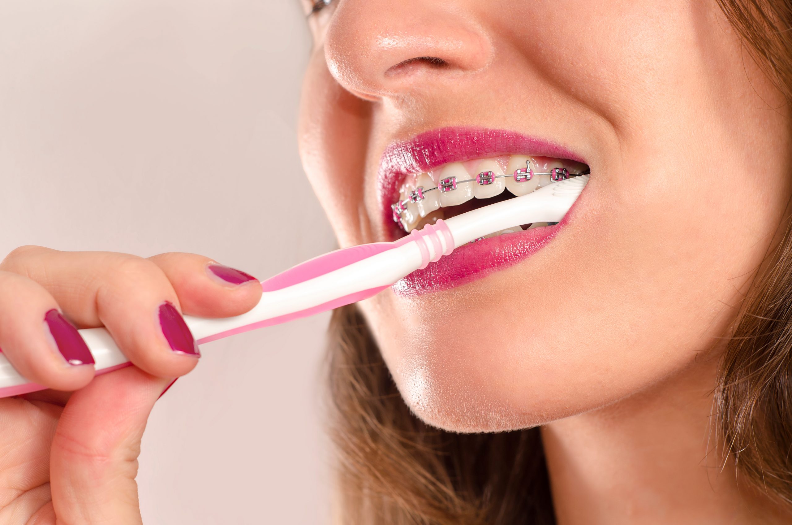 Appareil dentaire : aidez votre enfant à se brosser les dents comme il faut
